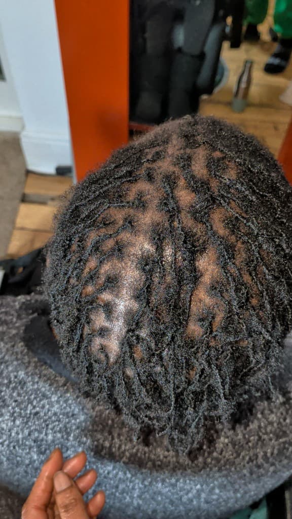 Sister locs installation — precision grid