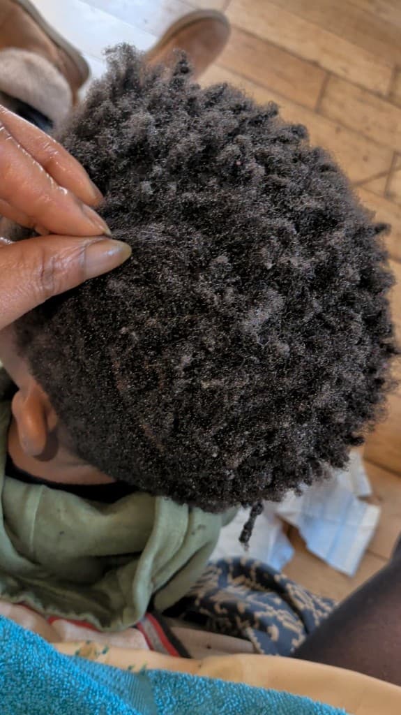 Short natural coils — consultation overhead
